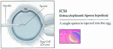 graphic icsi