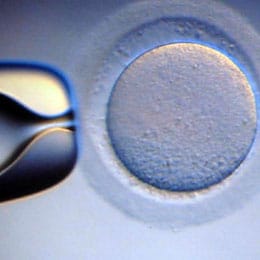1773429138_oocyte-retrieval-1